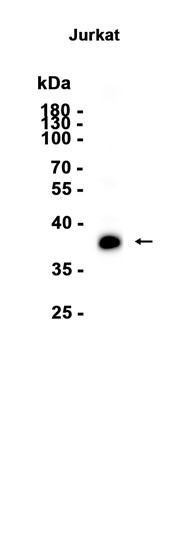 AYD15377