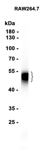 CD14 (YD15445) Rabbit mAb