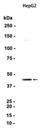 AYD14295