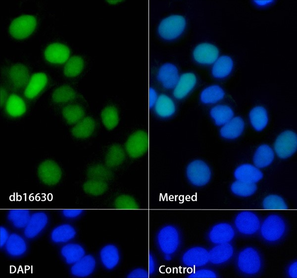 BATF (YD16366) Rabbit mAb