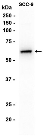 AYD14294