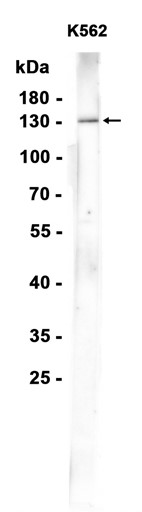 AYD14668