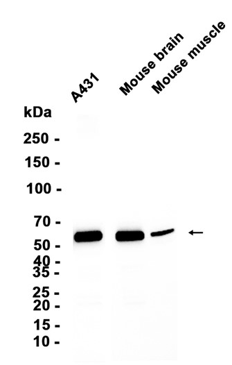 AYD11975