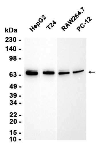 AYD13160