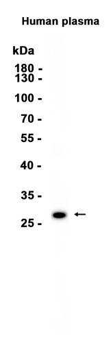 AYD13209