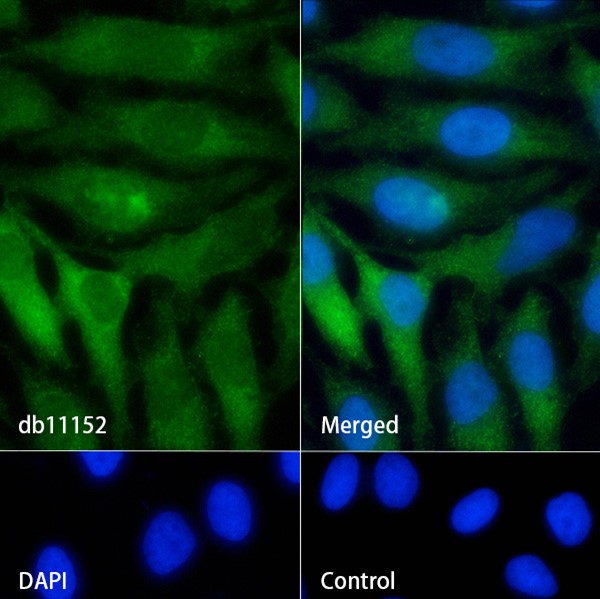Acetyl Coenzyme A carboxylase alpha (YD33609) Rabbit mAb
