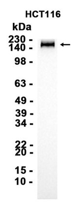 AYD14694