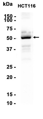 CaMKII beta (YD19083) Rabbit mAb