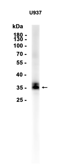 AYD12421
