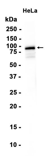 AYD11714