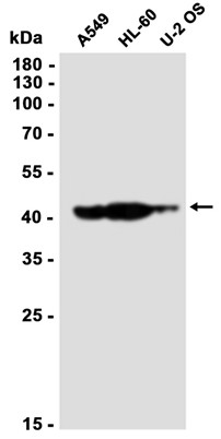 AYD14902