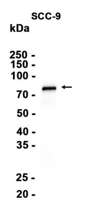 AYD11892