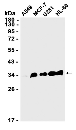 AYD12533