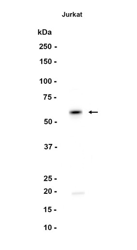 SMAD2/3 (YD12077) Rabbit mAb