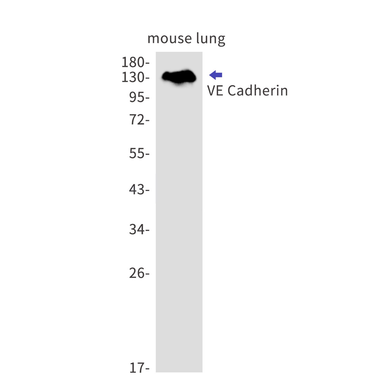 VE Cadherin (YD15078) Rabbit mAb