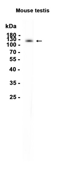 AYD14443