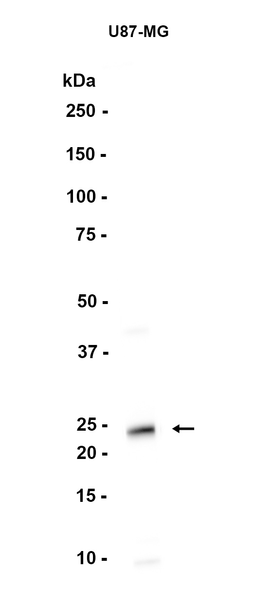 AYD11674