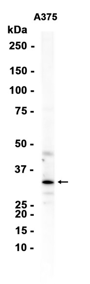 AYD13528