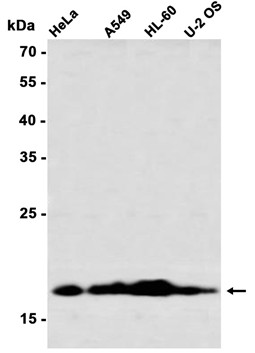 AYD14806