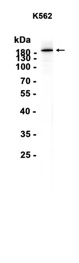 AYD15408