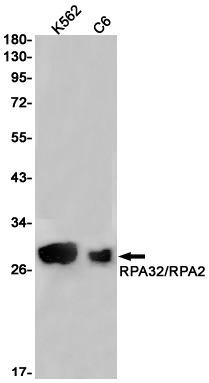 AYD11362