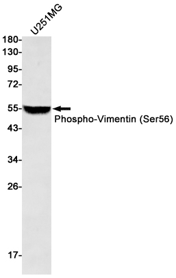 AYD14440