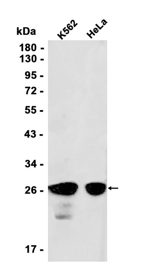 AYD11747