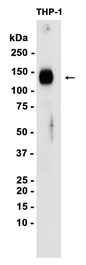 AYD12038
