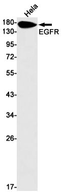 EGFR (YD11894) Rabbit mAb