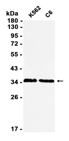 AYD11523