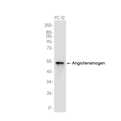 AYD14800