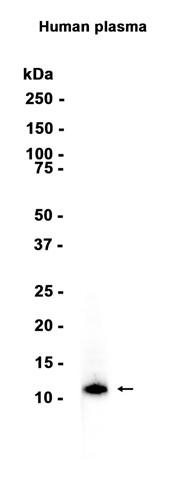 AYD14869