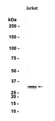 AYD13640