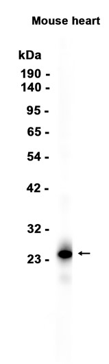 AYD15357