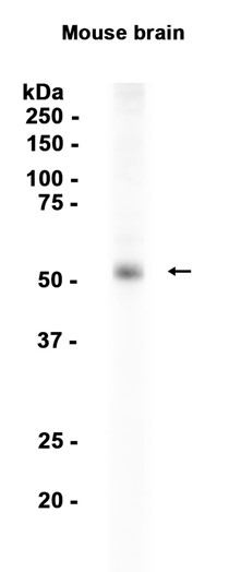 Inhibin beta B (YD14970) Rabbit mAb
