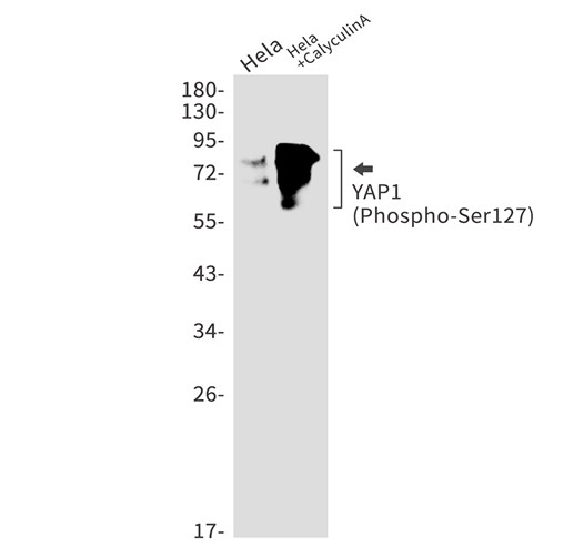 AYD13334