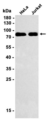 AYD14672