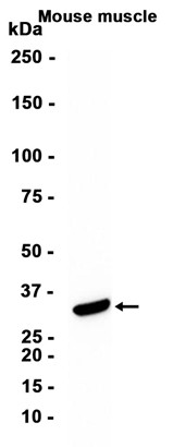 AYD11378