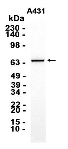 IRAK2 (YD20893) Rabbit mAb