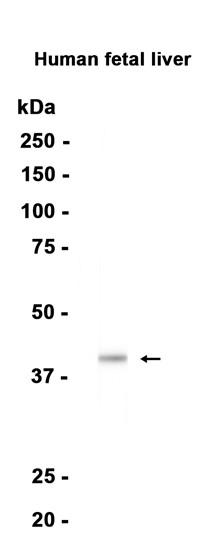 AYD15835