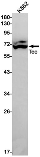Tec (YD18840) Rabbit mAb