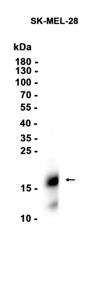 AYD15849