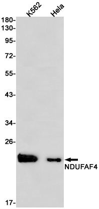 AYD13101
