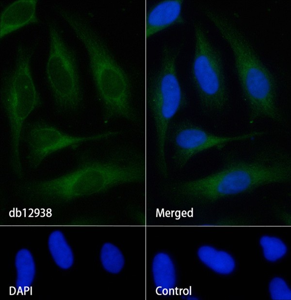 S100A9 (YD19056) Rabbit mAb