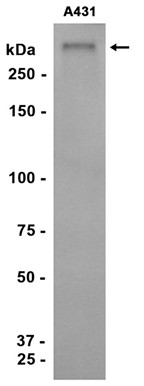 AYD14184