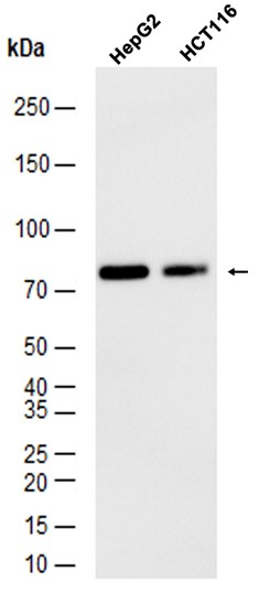 Androgen Receptor(AR-V7 specific) (YD11838) Rabbit mAb