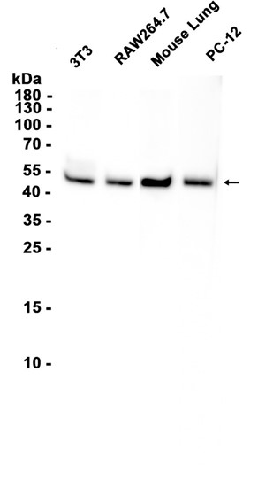 AYD11363