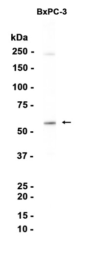 AYD14359