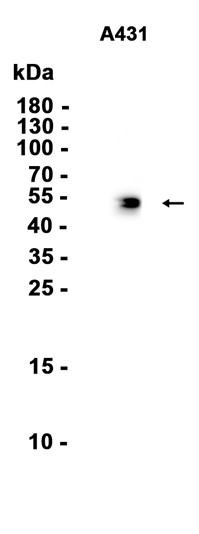 Cytokeratin 14 (YD13928) Rabbit mAb