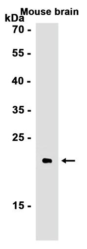 RAS (YD17077) Rabbit mAb